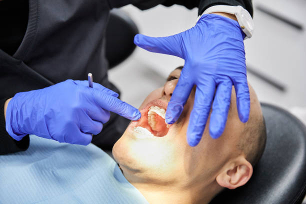 Best Emergency Tooth Extraction in Elba, AL